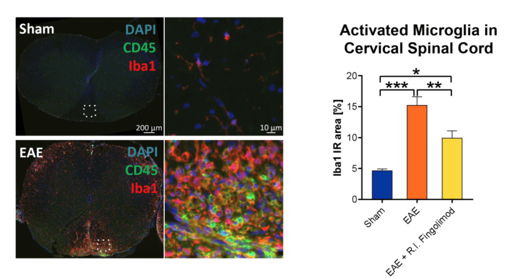 Neuroinflammation