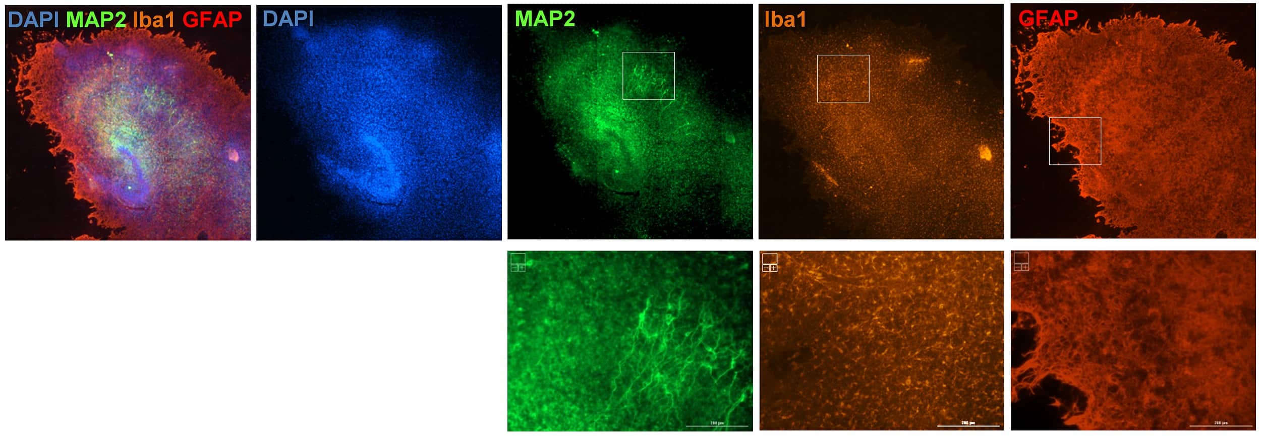 4.-Brain slices images Brain slices images