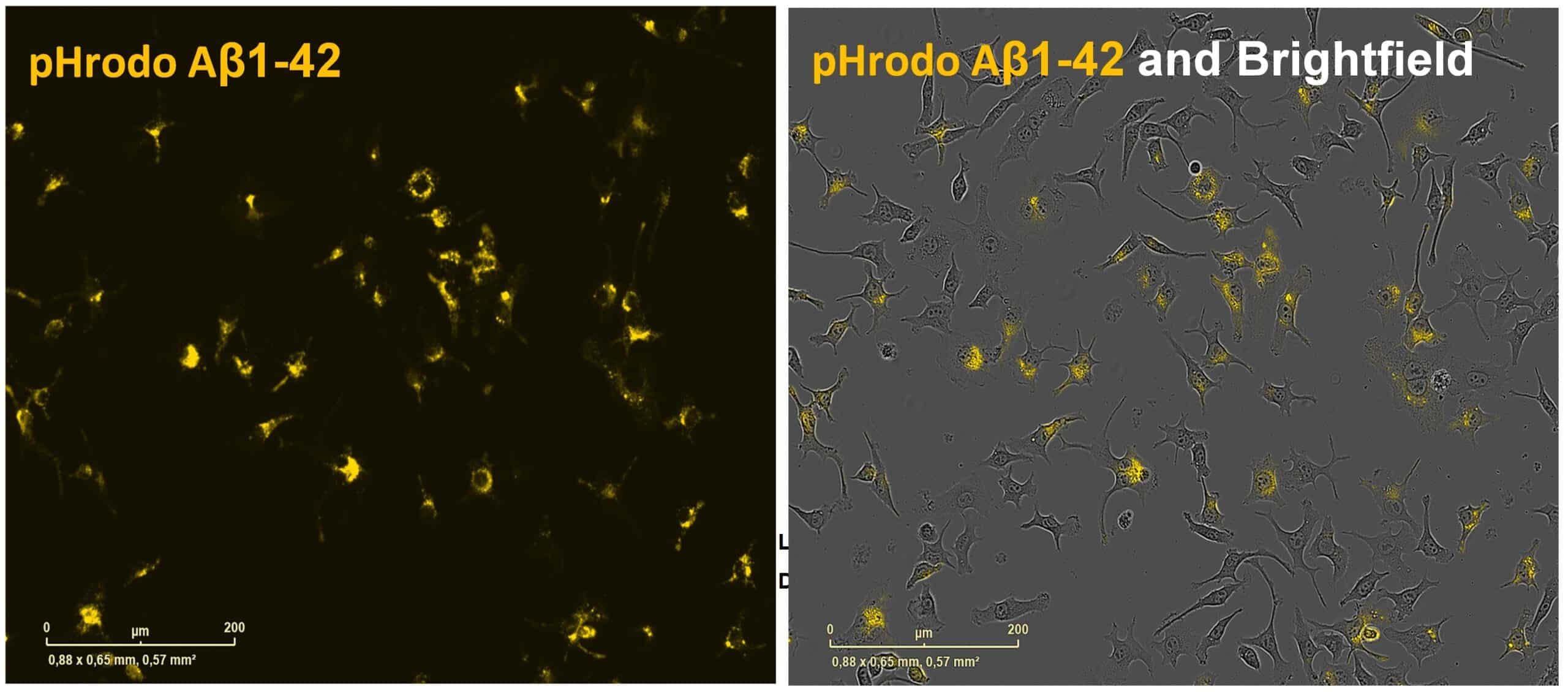 Figure 2-Phagocytosis Figure 2-Phagocytosis