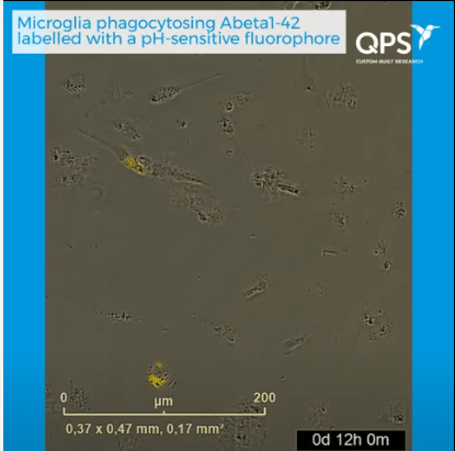 Video-Phagocytosis-Image Video-Phagocytosis-Image